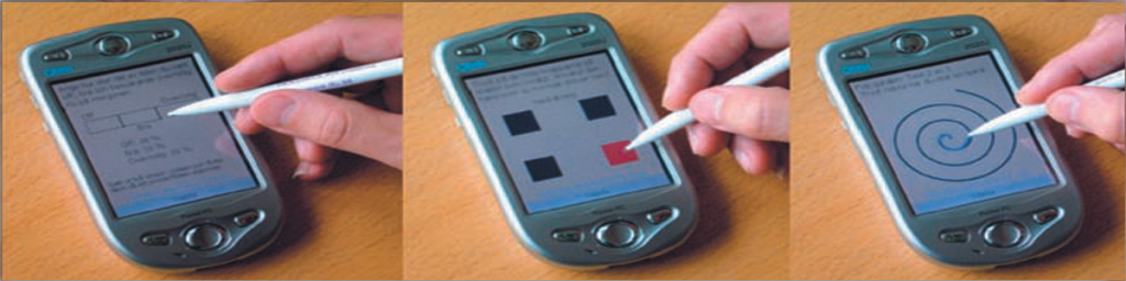 A mobile-based system can assess Parkinson’s disease symptoms from home environments of patients