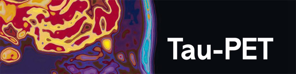 Tau-PET – en framtida diagnosmetod?