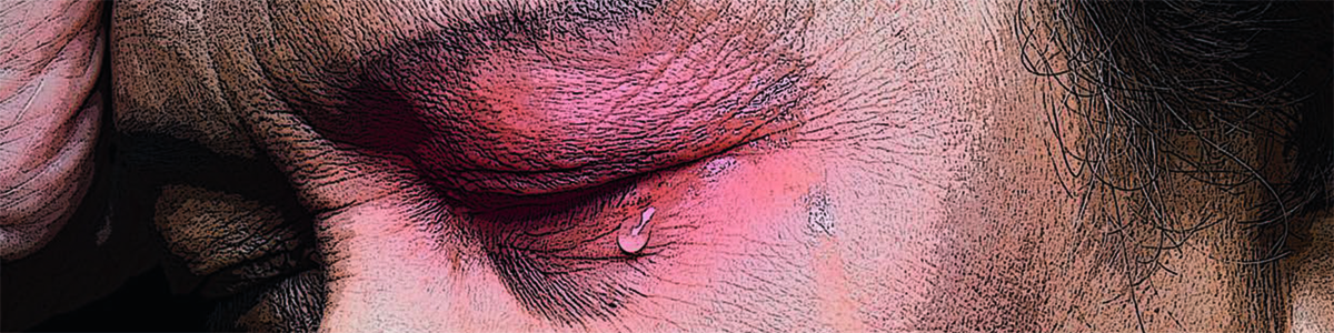 SPG-stimulering vid behandlingsresistent klusterhuvudvärk