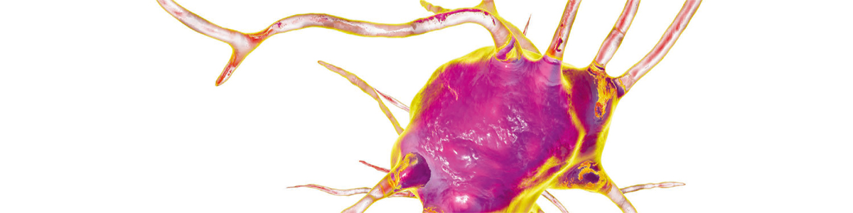 I alzheimerhjärnan sprids giftigt oligomert beta-amyloid med hjälp av exosomer