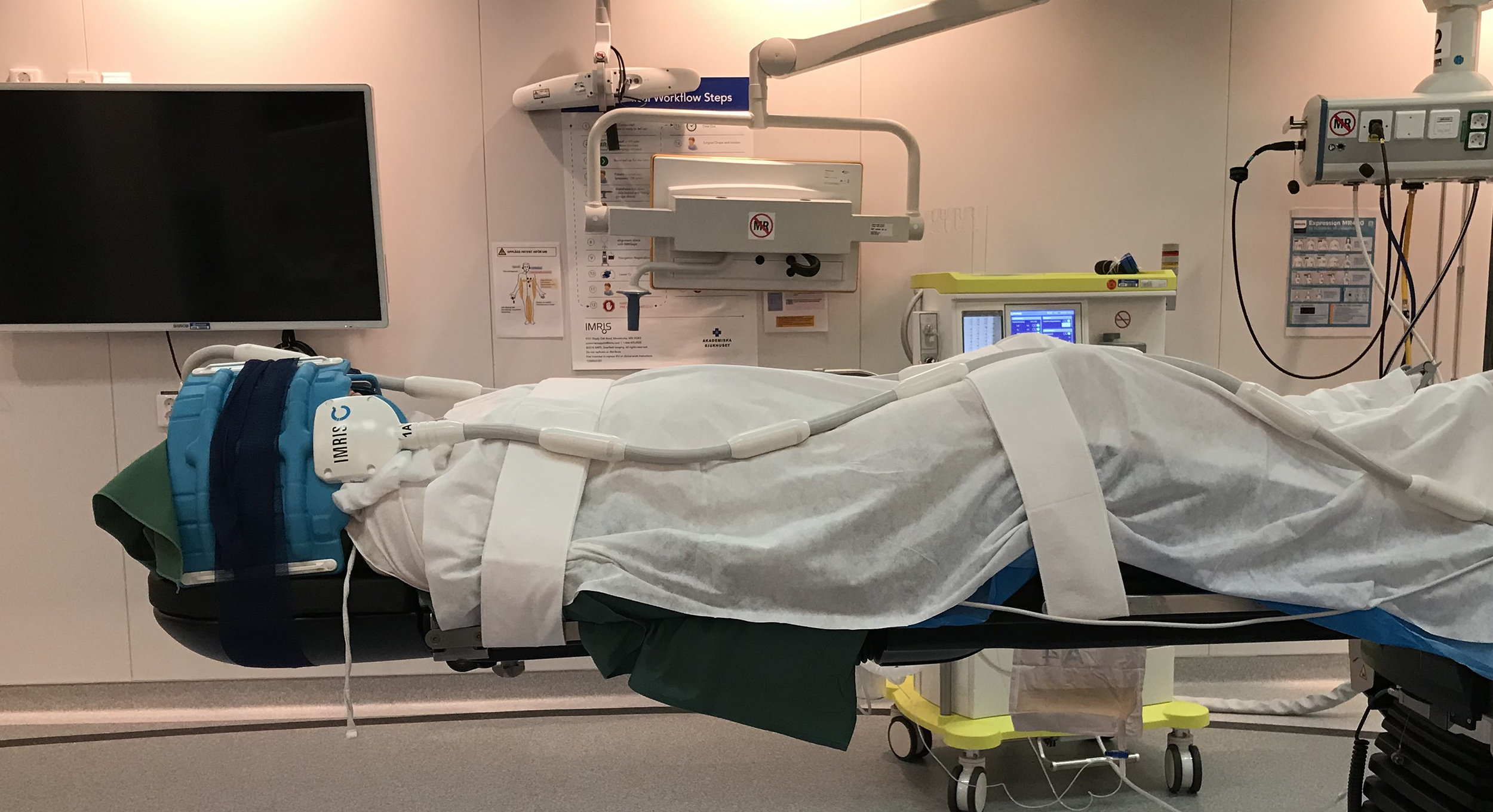 Först i Norden med uppgraderad teknik och effektiviserat flöde för DBS-behandling vid Parkinson