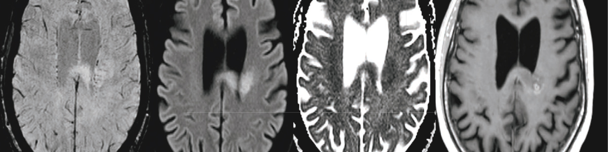 Neuroradiologisk A-B och C-D-lära, Del 3. I – L