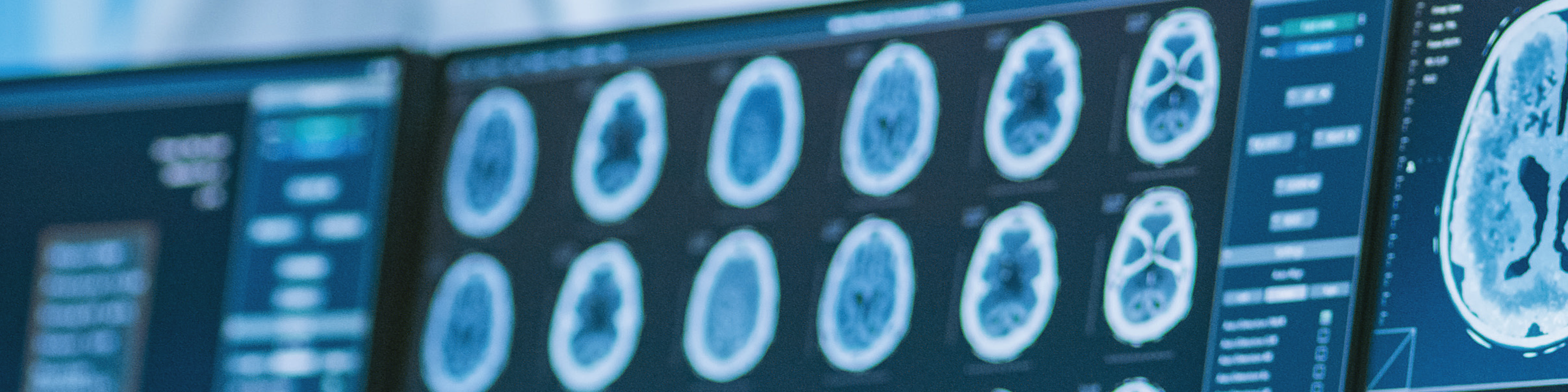 Neuroradiologisk A-B och C-D-lära