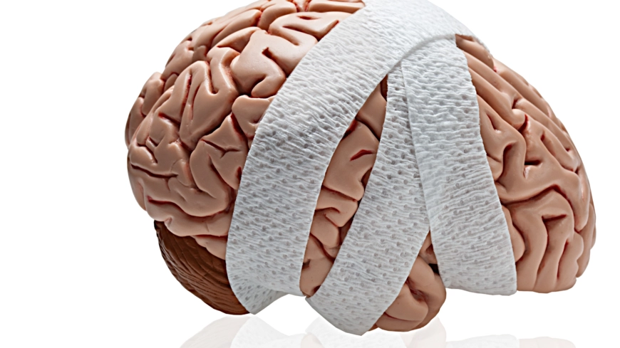 Hjärnskadekoordinatorer kan förbättra livskvaliteten efter en stroke eller annan hjärnskada