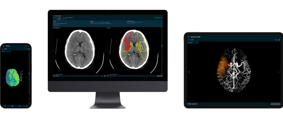 Akademiska inför AI-system för automatisk tolkning av strokebilder