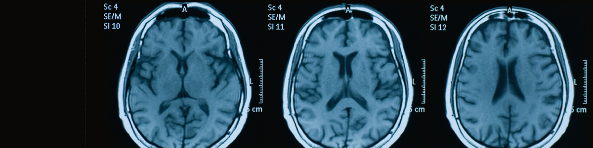 En gedigen grund i neuroradiologi – kursen som ger mer än bara teori