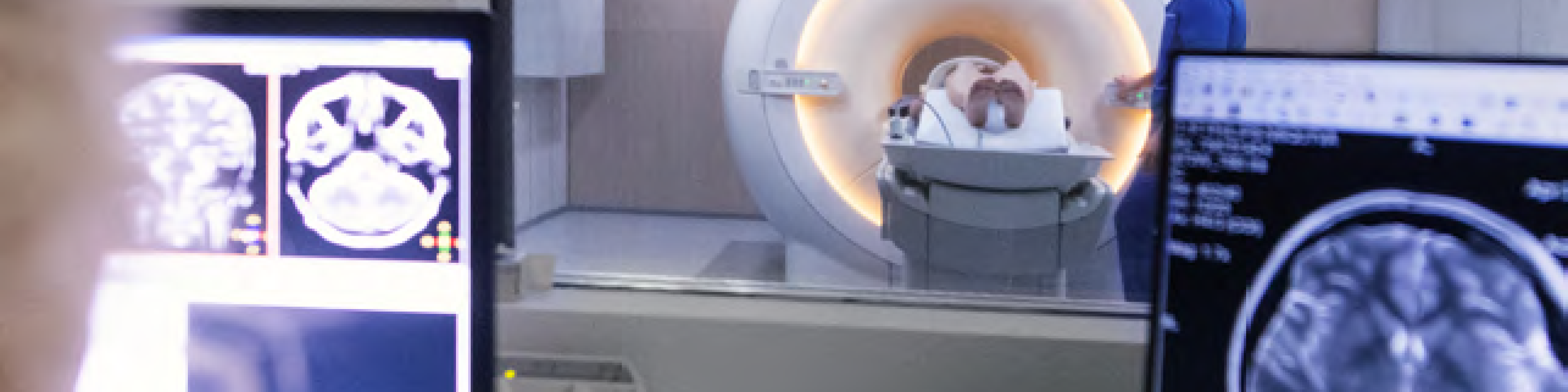 Varierande fynd på FDG-PET vid autoimmun encefalit