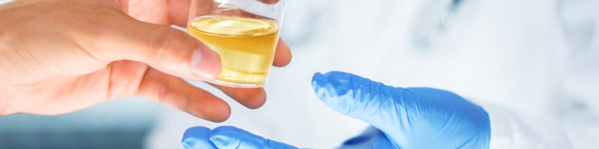 Proteinuri – biomarkör som avslöjar dold risk