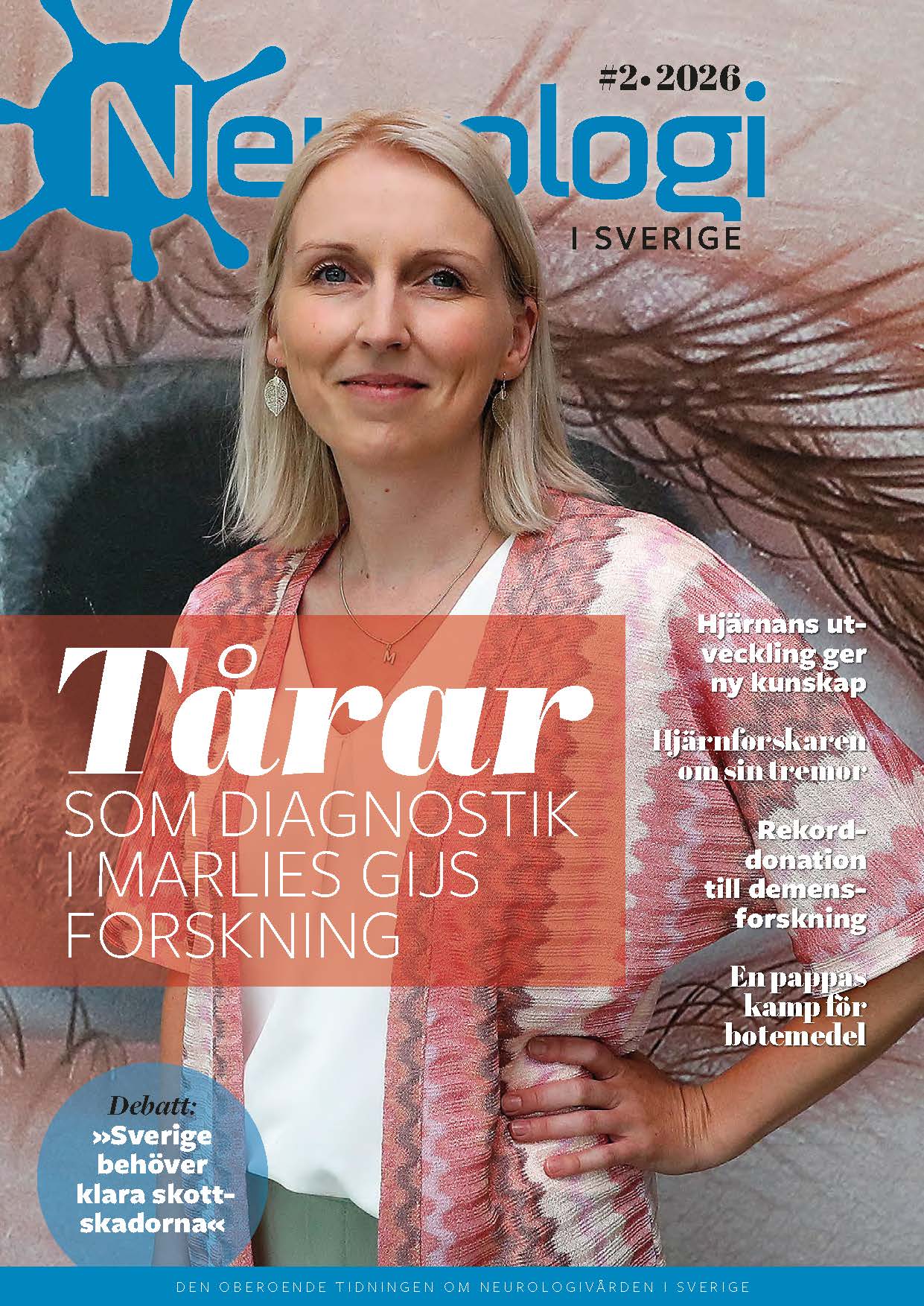 Neurologi i Sverige Nr 2 2026 ute nu!